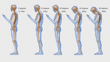 Postural affects of "Text Neck"